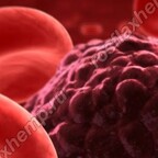 Медкан мj и онкология крови