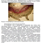 Сравнительное морфолого-анатомическое исследование видов рода LINUM - льна жилковатого и льна Желтоватого